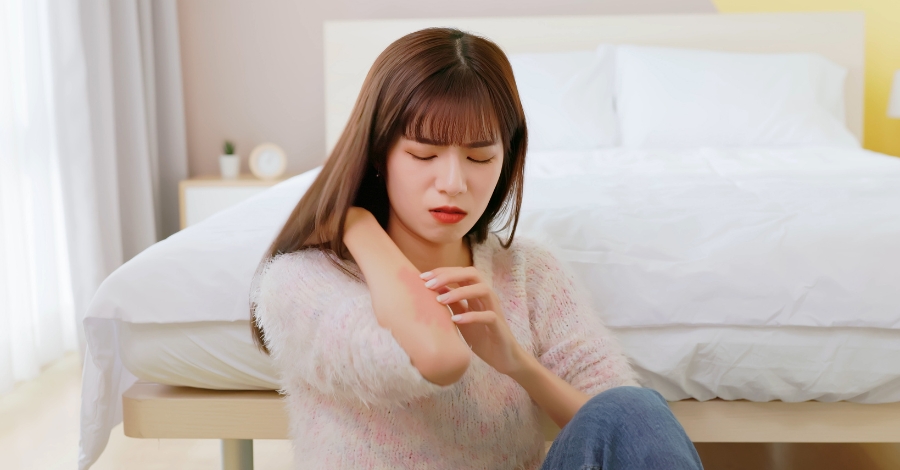 COMO É A COCEIRA DO STRESS